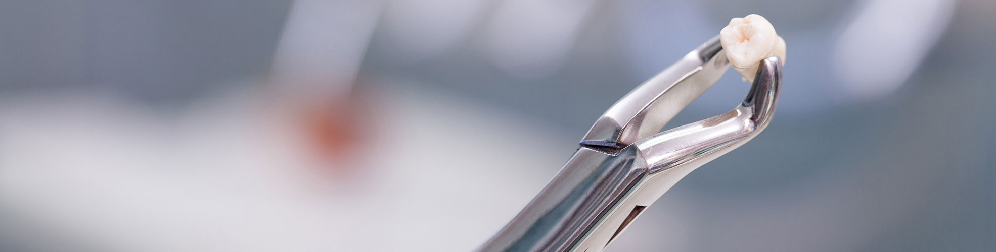 chirurgia orale dente con pinza