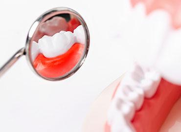 controllo delle gengive per chirurgia