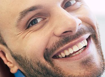 Amalgama dentale dentista pescara Paolo Fulgenzi