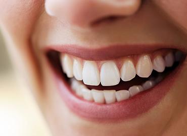 Denti sani. Studio dentistico Fulgenzi Paolo a Pescara