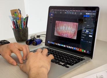 digital smile design